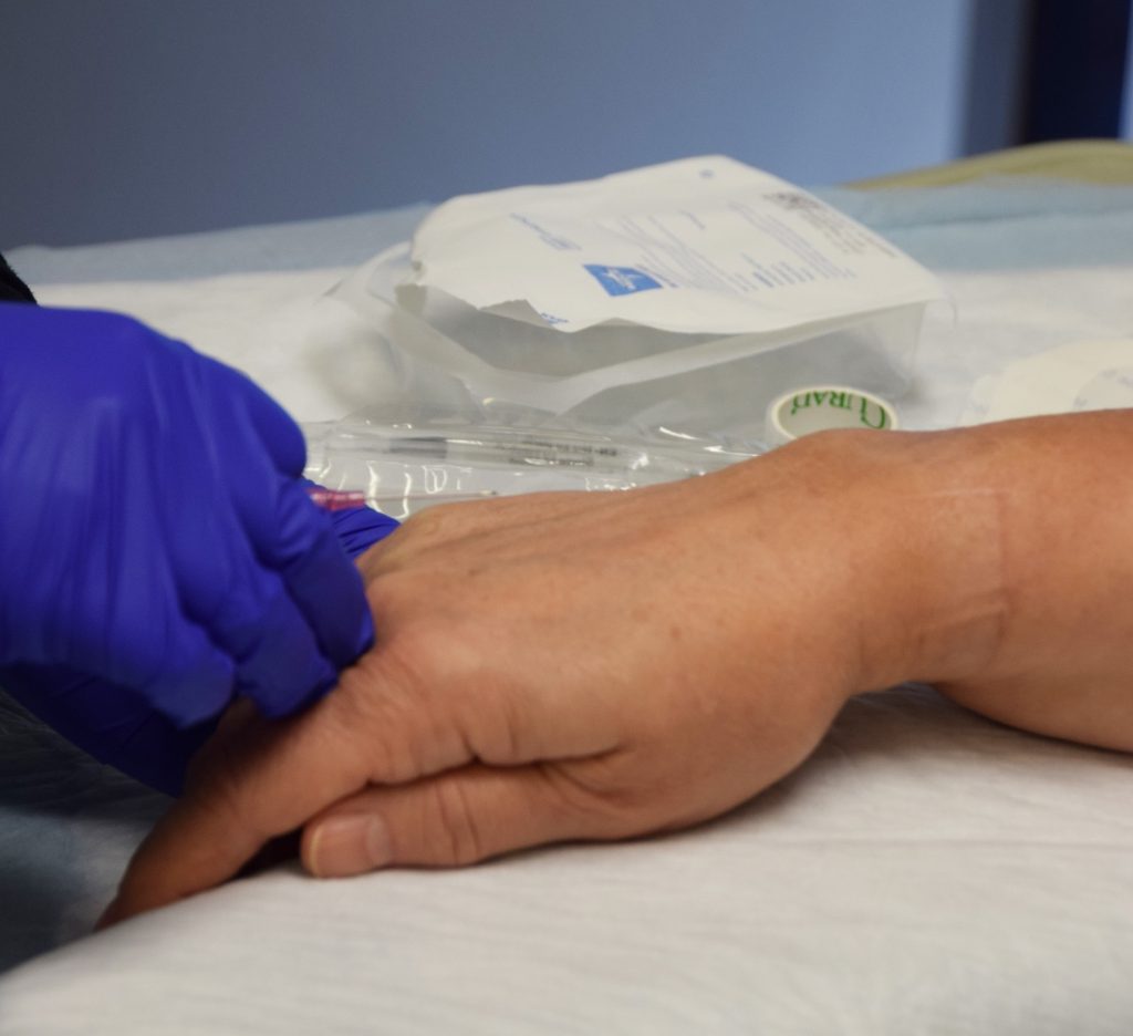 close up of a hand on a table getting an IV put in.